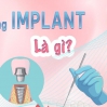 Bảng giá trồng răng Implant tại Đà Nẵng