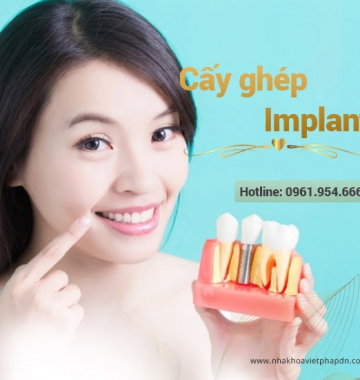 Cấy ghép Implant tại Đà Nẵng