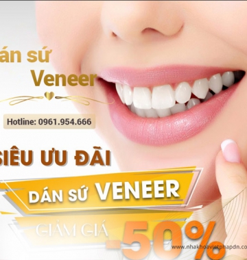 Dán sứ Veneer tại Đà Nẵng