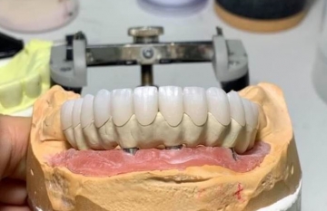 Răng sứ Zirconia là gì? Bọc sứ Zirconia có thật sự tốt không?