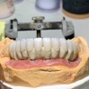 Răng sứ Zirconia là gì? Bọc sứ Zirconia có thật sự tốt không?