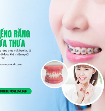 Niềng răng thưa bao lâu hiệu quả và thời gian cần thiết
