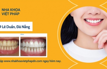 Giải Đáp Thắc Mắc Làm Trắng Răng Có Đau Không?