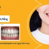 Giải Đáp Thắc Mắc Làm Trắng Răng Có Đau Không?