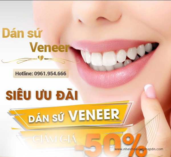 Dán sứ Veneer tại Đà Nẵng