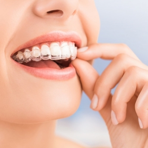 Niềng răng chỉ từ 15 Triệu Niềng răng chỉ từ 15 Triệu