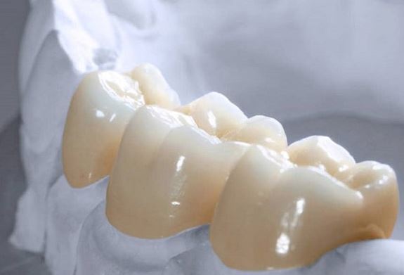 Răng sứ Zirconia