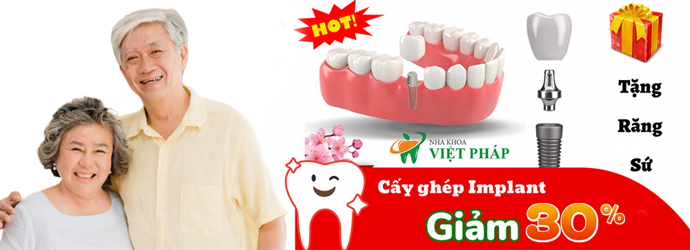 cấy ghép implant