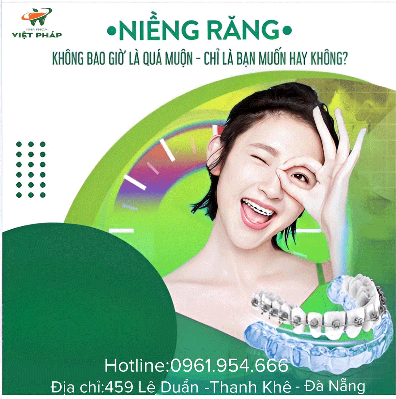 Niềng răng là gì? chi phí trả góp niềng tại nha khoa việt pháp