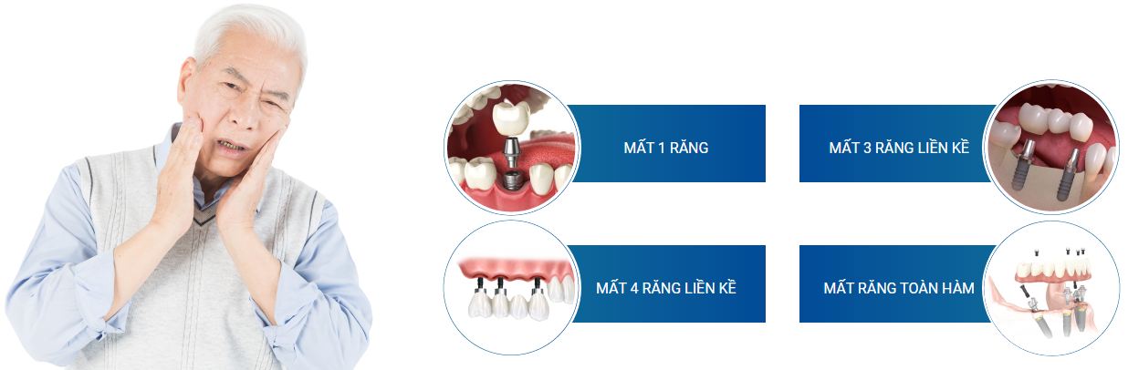 trồng răng Implant tại Đà Nẵng
